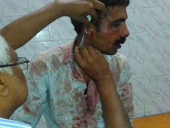 मीडियाकर्मी को तीन घंटे तक चलती कार में पीटते रहे, सोता रहा दारोगा