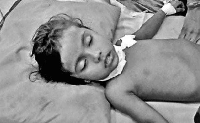 बीरपाड़ा : तेंदुए के हमले में बच्ची घायल