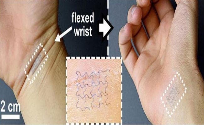 Health News: अापकी सेहत में उतार-चढ़ाव को लेकर आगाह करेगा यह स्मार्ट स्टिकर