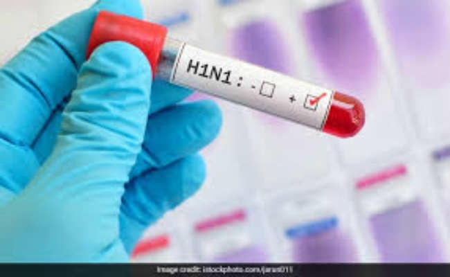 डेंगू के बाद अब स्वाइन फ्लू का डर , सॉल्टलेक में स्वाइन फ्लू से महिला की हुई मौत