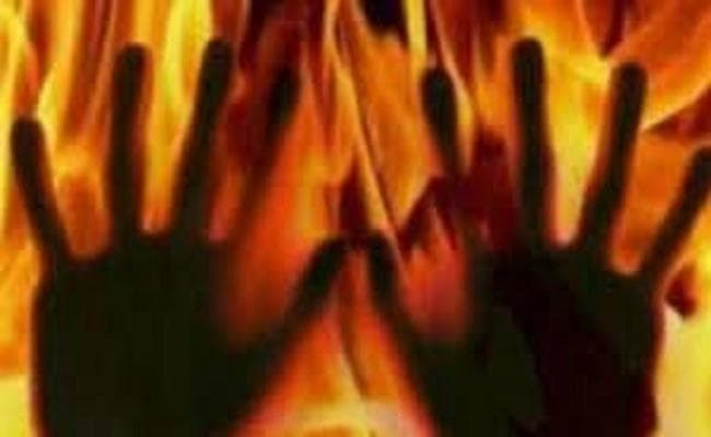 सनकी पिता की करतूत, दो मासूमों को किया आग के हवाले, ढाई वर्षीय बच्चे की मौत