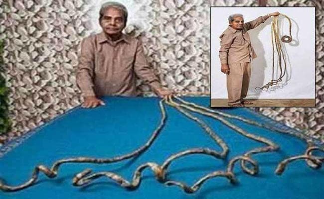 आखिरकार श्रीधर चिल्लाल ने काटा नाखून, लेकिन अब हाथ हुआ बेजान क्योंकि…