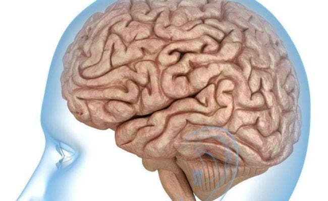IIIT-H ने तैयार किया भारतीयों के दिमाग का पहला एटलस, पश्चिमी देशों से छोटा होता है ब्रेन का स्ट्रक्चर