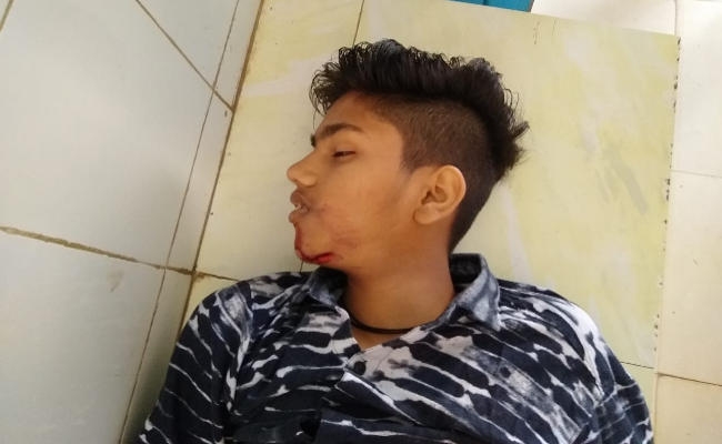 हजारीबाग रोड पर सड़क दुर्घटना में युवक की मौत, दो घायल