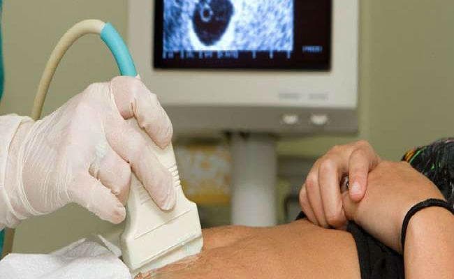 रांची : महिला डॉक्टर की गिरफ्तारी का विरोध जारी, सदर अस्पताल में भी नहीं की गयी अल्ट्रासाउंड जांच