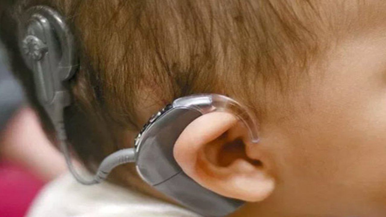 Cochlear Implant से चार साल के मूक-बधिर बच्चे की बदल गई जिंदगी, सरकार के सहयोग से फ्री में ऑपरेशन