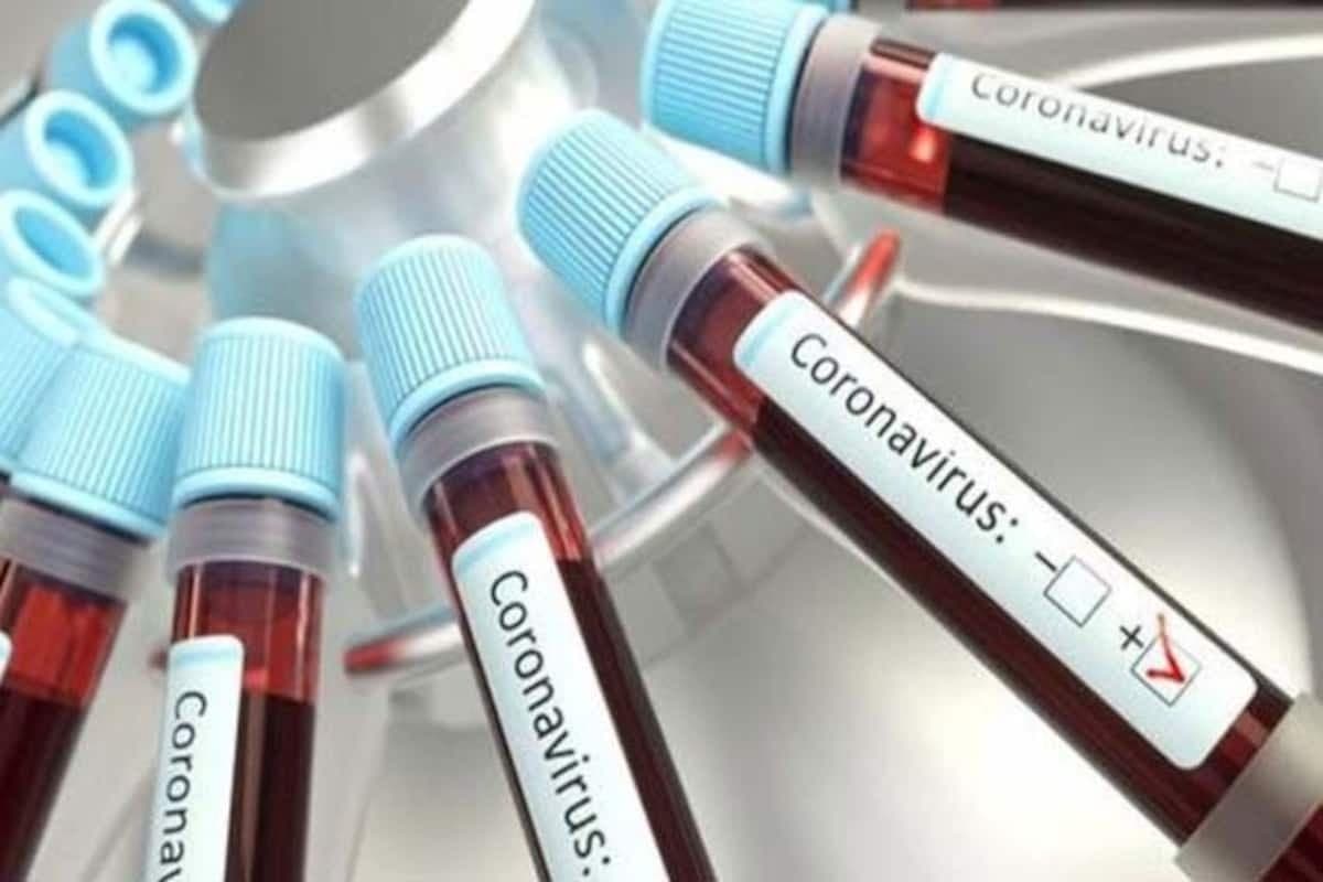 CoronaVirus Jharkhand : 119 नये संक्रमित मिले, हिंदपीढ़ी थाना के छह और पुलिसकर्मी भी शामिल