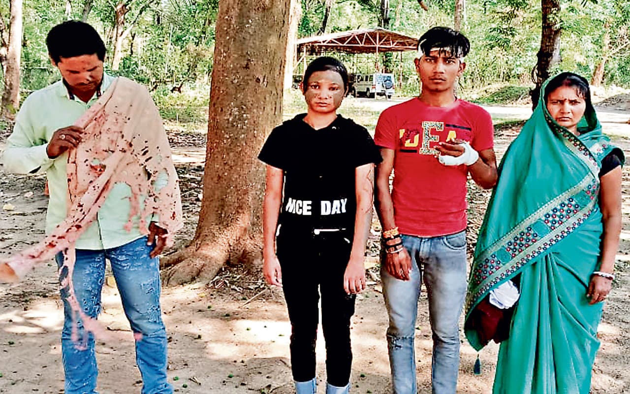 दुमका एसिड अटैक मामला : पीड़ित परिवार ने एसपी से लगायी न्याय की गुहार, छप्पर छारने के दौरान हुआ था विवाद