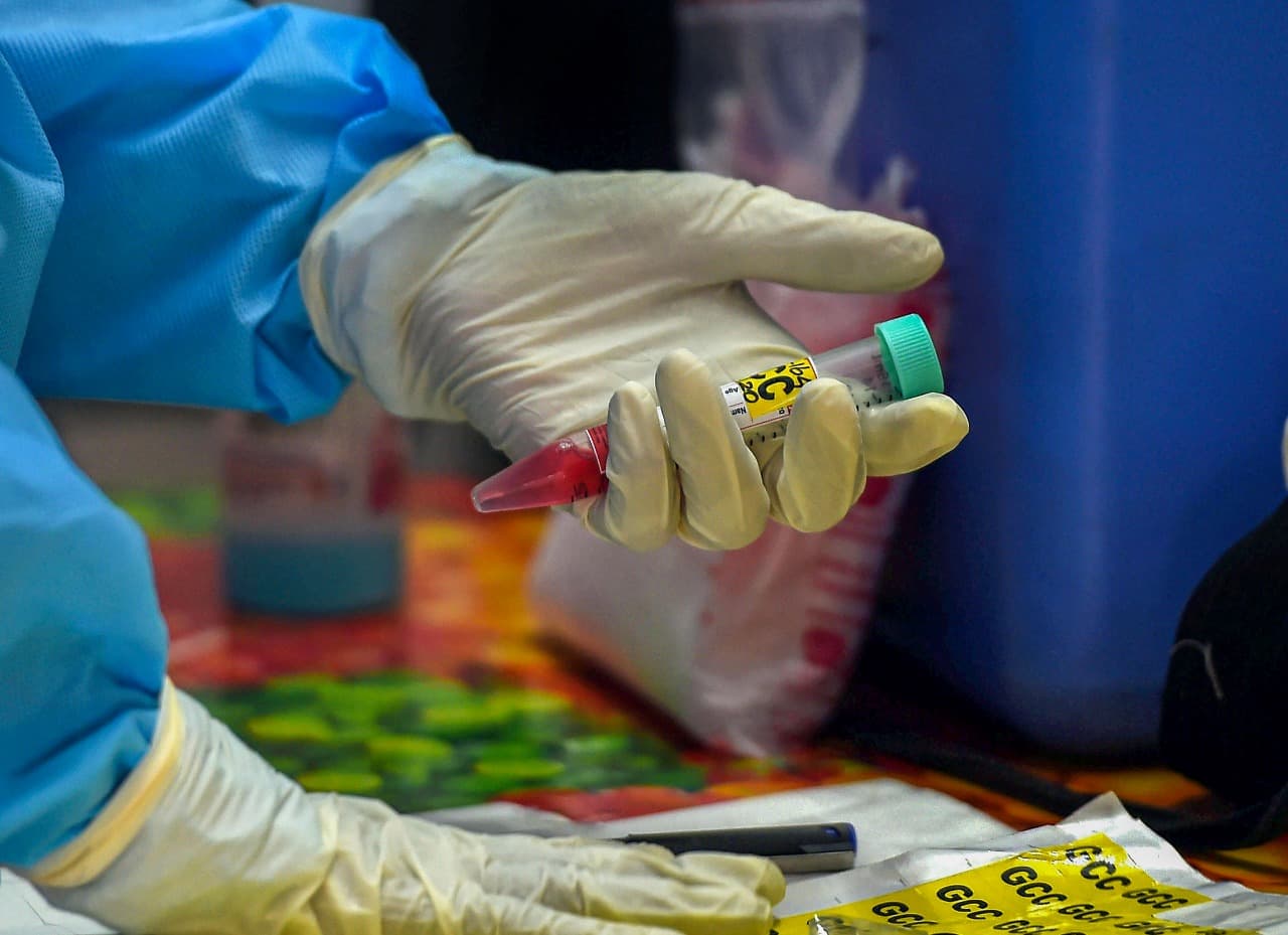 Coronavirus Noida News Update : कोविड-19 पाबंदियों का उल्लंघन मामला, अब तक लगभग 8,300 लोगों को पुलिस ने पकड़ा