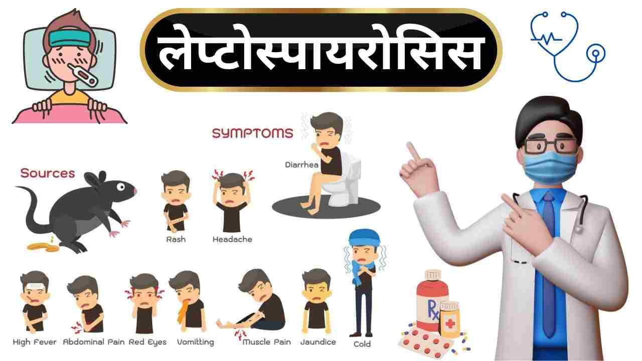 यूपी में लेप्टोस्पायरोसिस ने पसारे पैर, जानें बारिश में क्यों हो जाता है बेहद खतरनाक, लक्षण और बचाव के उपाय