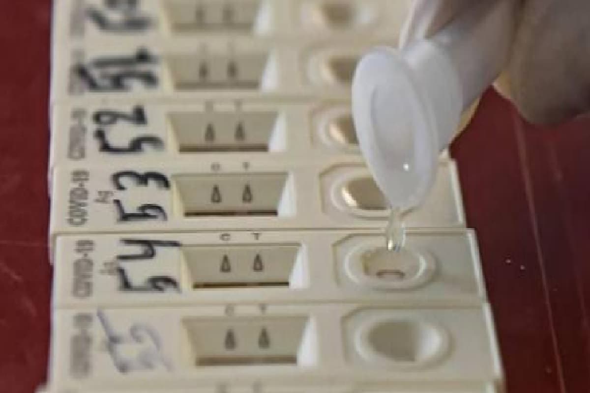 क्या आपका RTPCR टेस्ट निगेटिव आया? तब भी आप हो सकते हैं कोरोना पाॅजिटिव, इस टेस्ट से सच्चाई आती है सामने…
