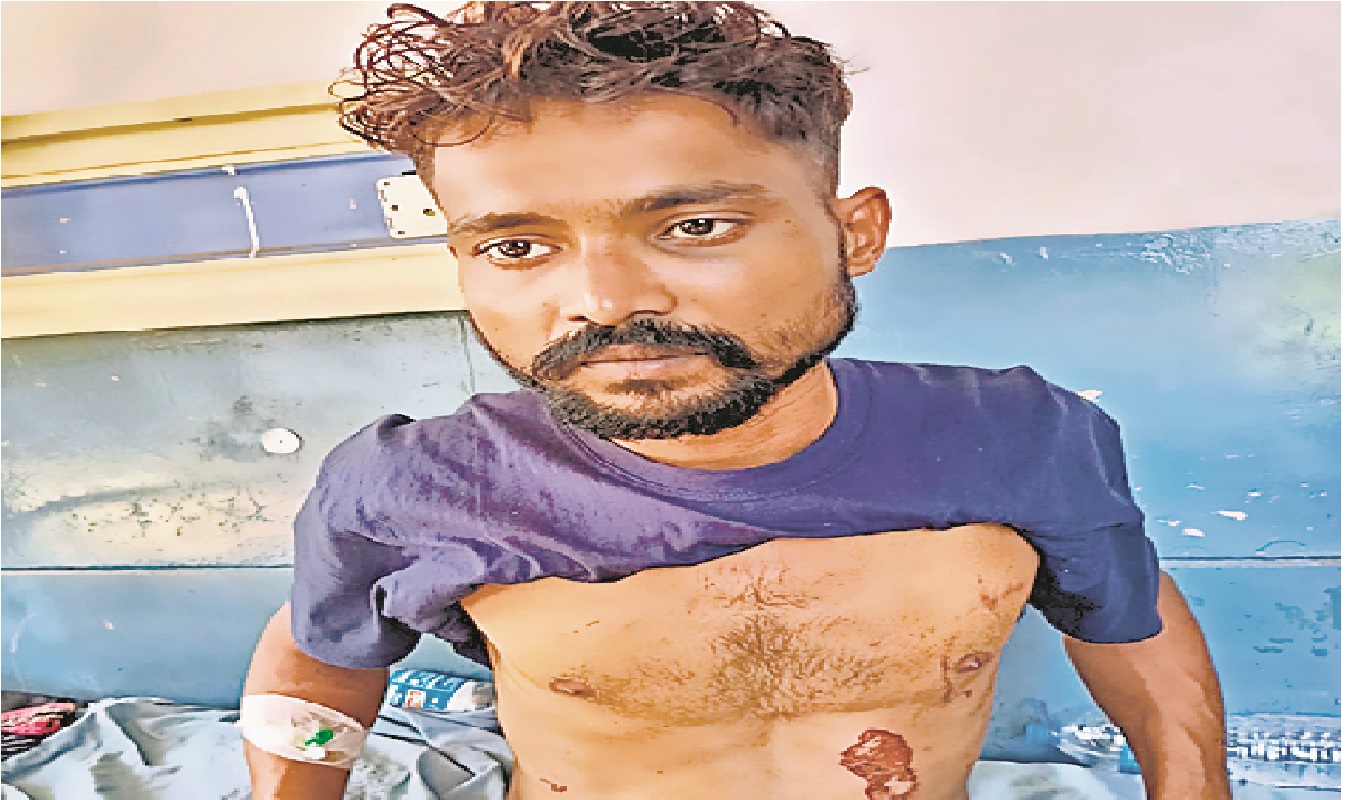 पटना में गर्लफ्रेंड और पत्नी के सामने लुटेरे बिट्टू ने थाने में खुद को लगायी आग, भागने की कोशिश