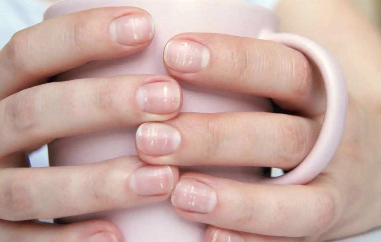 White Marks On Nails: क्या आपके नाखून पर है सफेद निशान? जानें क्या कहता है समुद्र शास्त्र