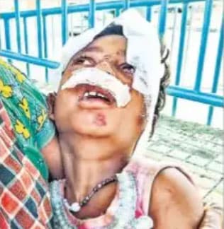 घायल सोनोती तड़प रही थी पर पुलिस ने की अनदेखी : श्याम मीरा सिंह