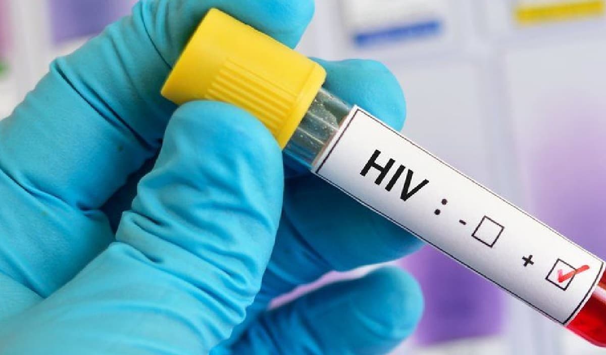 HIV पर मिलेगी जीत ? भारतीय वैज्ञानिकों ने विकसित किया नैनो एंजाइम