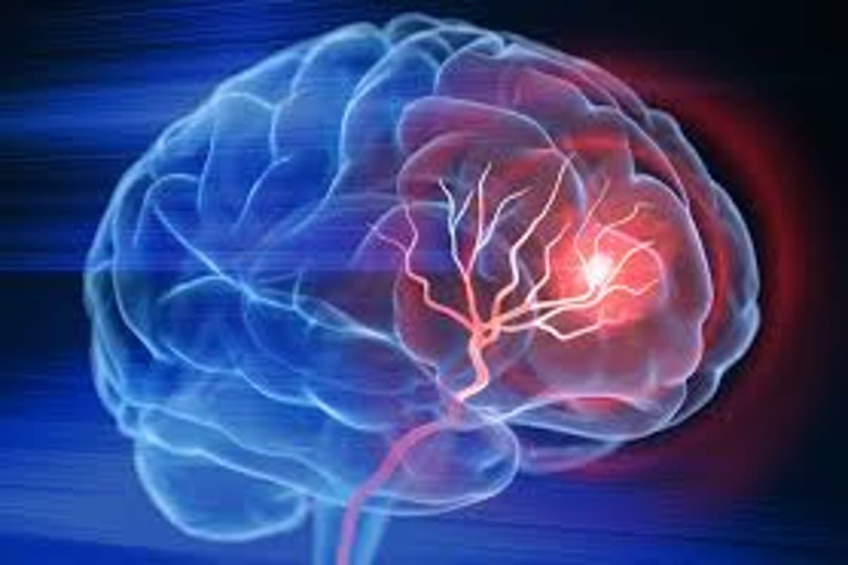 Nithin Kamath Mind Stroke: जेरोधा के फाउंडर और CEO नितिन कामत को आया माइल्ड स्ट्रोक, जानें इसके पीछे का कारण