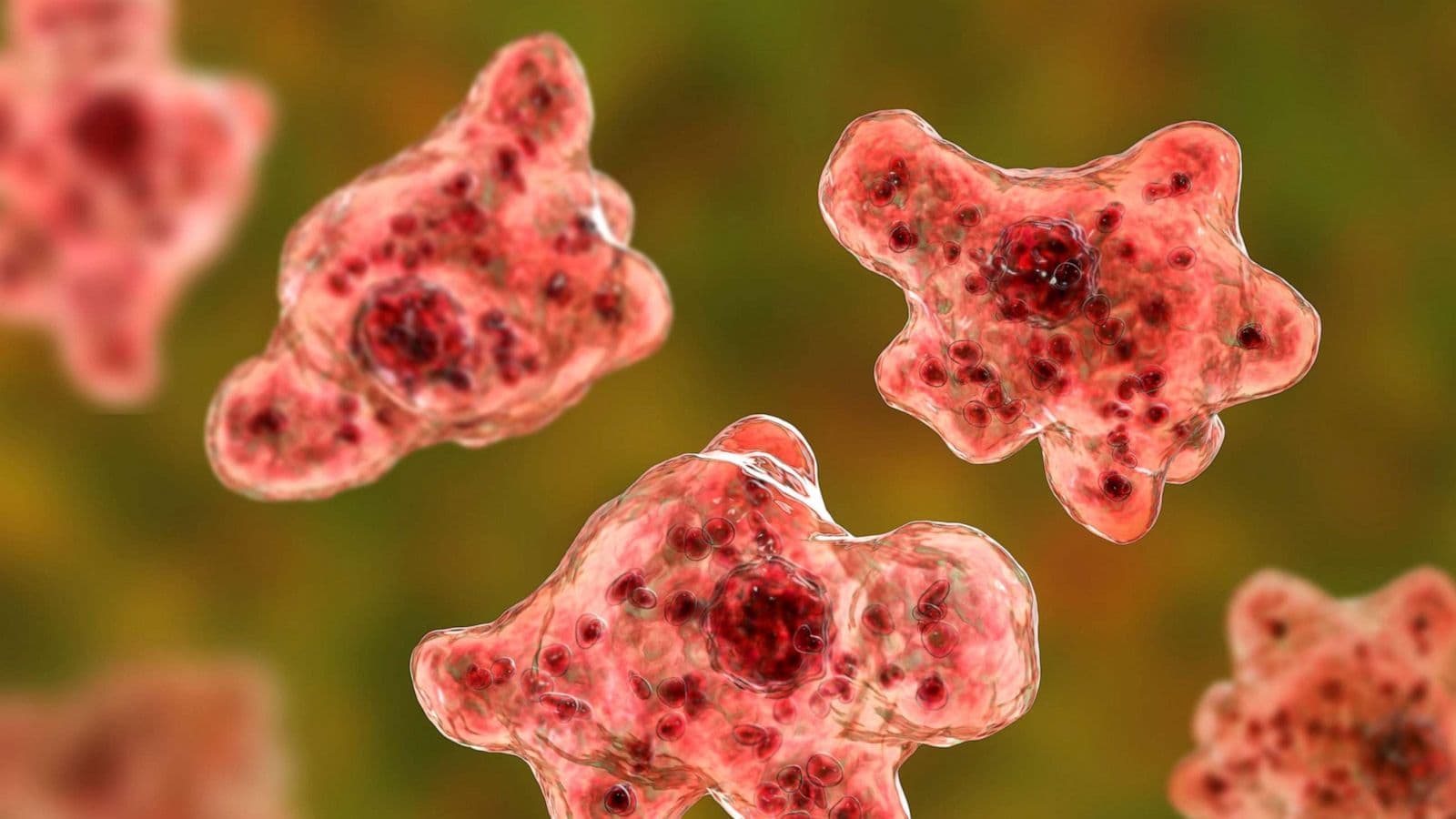 How to prevent from Amoeba Disease : ब्रेन-ईटिंग अमीबा बीमारी के क्या है लक्षण, जानें कैसे करें बचाव