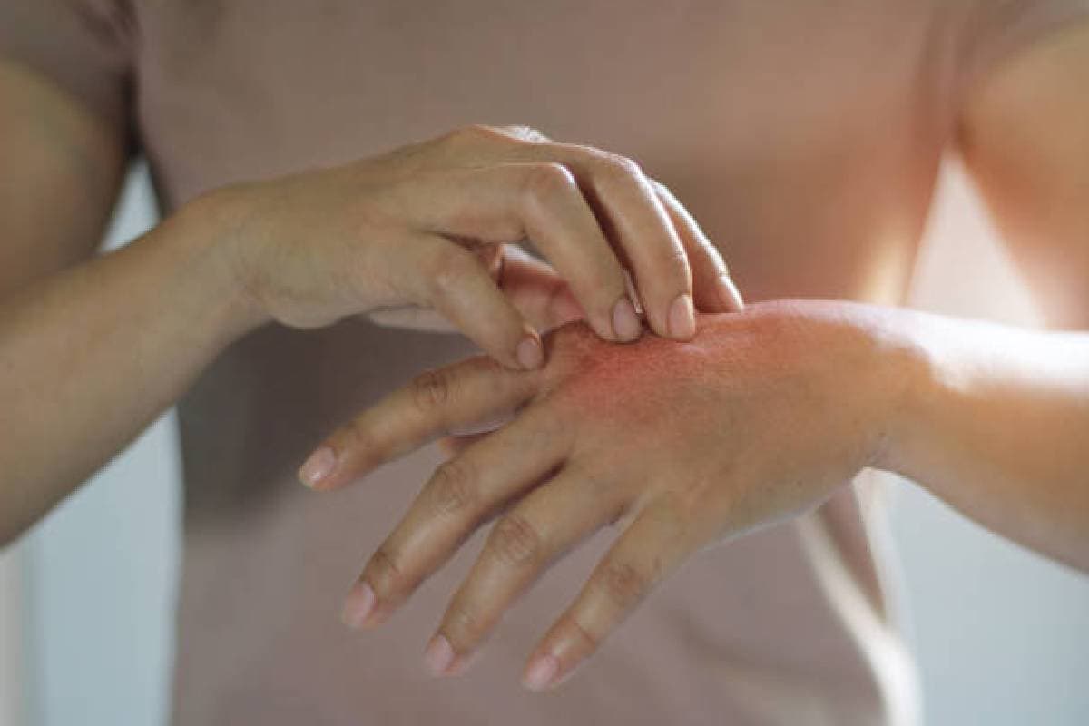 Skin Problems: बदलते मौसम में ऐसे रखें अपनी त्वचा का ख्याल, नहीं होगी खाज खुजली, फॉलो करें ये 5 टिप्स