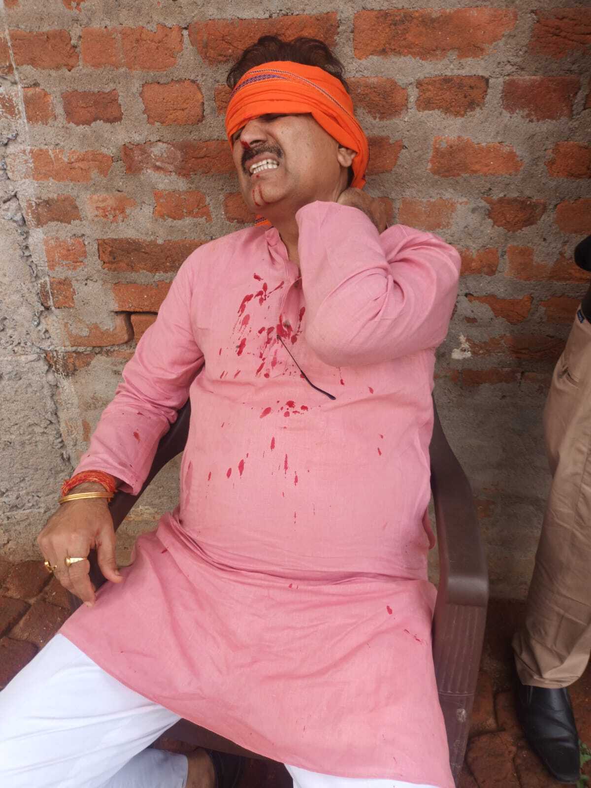 हादसे में भाजपा जिलाध्यक्ष समेत चार घायल