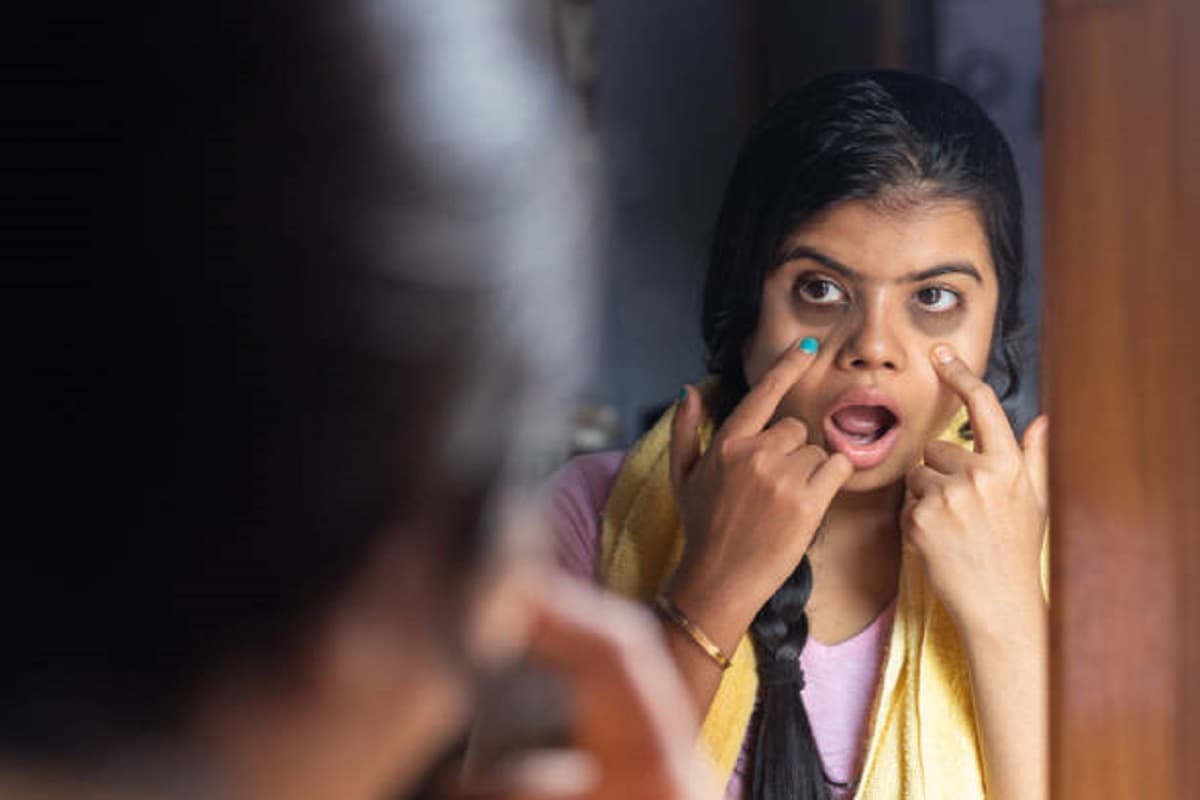 Beauty Tips: डार्क सर्कल हटाने के लिए फॉलो करें ये आसान घरेलू उपाय