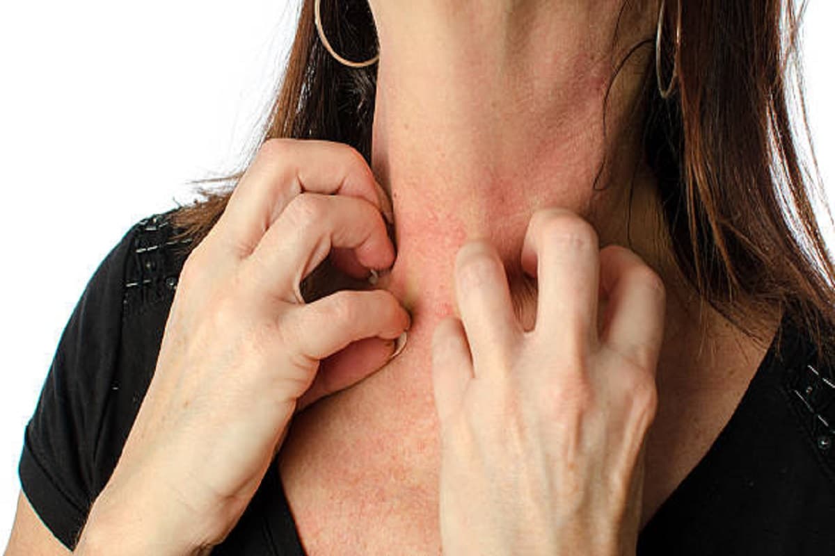 Monsoon Skin Care: बारिश के मौसम में होनी वाली स्किन ऐलर्जी से बचने के लिए फॉलो करें ये तरीके