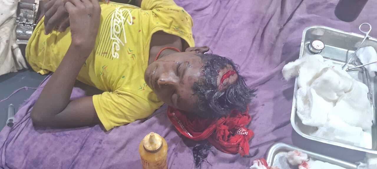 गंगा पुल एप्रोच पथ पर सड़क दुर्घटना में घायल 14 वर्षीय किशोर की मौत