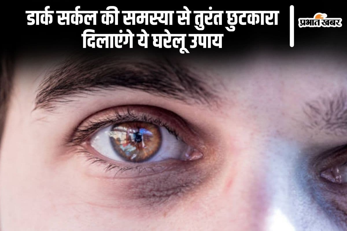 Skin Care Tips: डार्क सर्कल की समस्या से तुरंत छुटकारा दिलाएंगे ये घरेलू उपाय