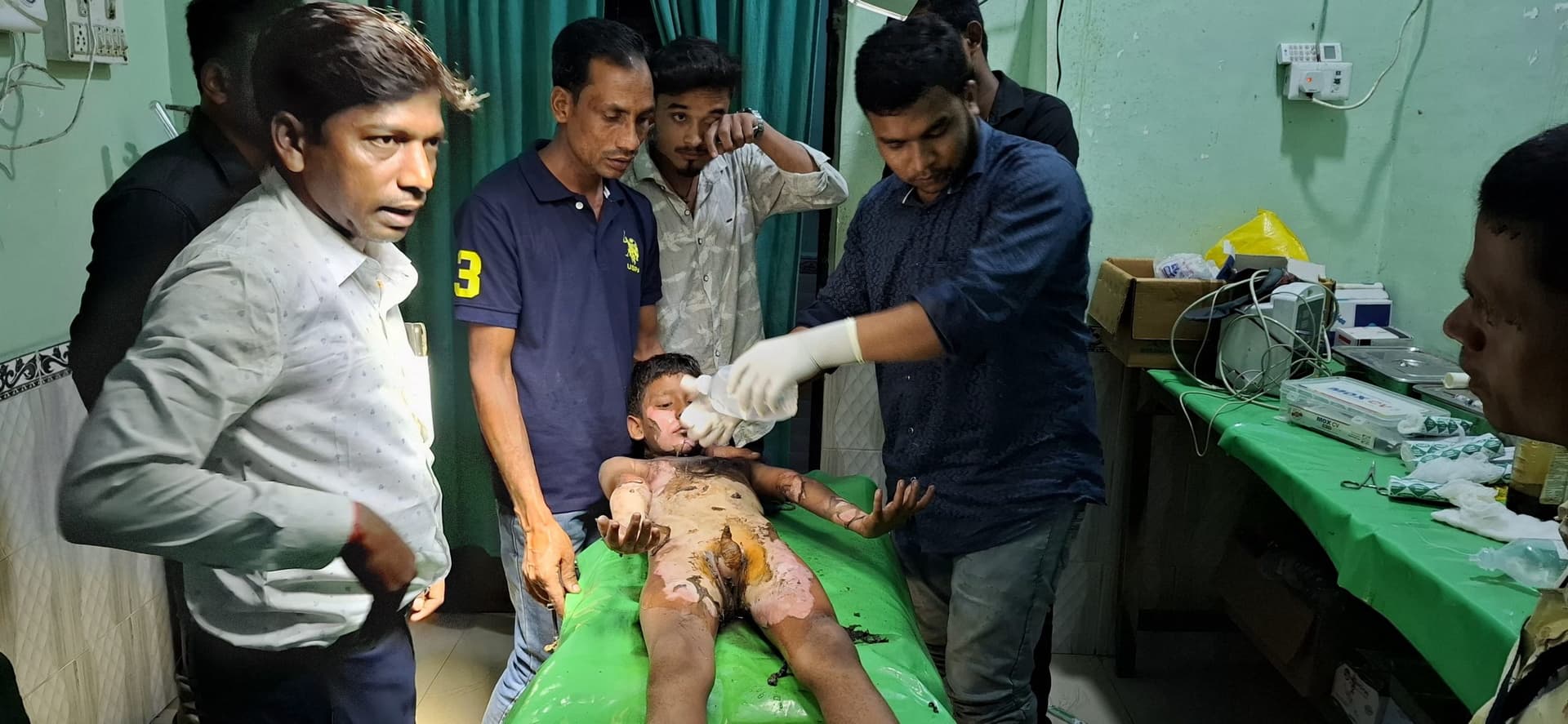 बच्चे के पॉकेट में रखा बम हुआ ब्लास्ट, दादा-पोता जख्मी