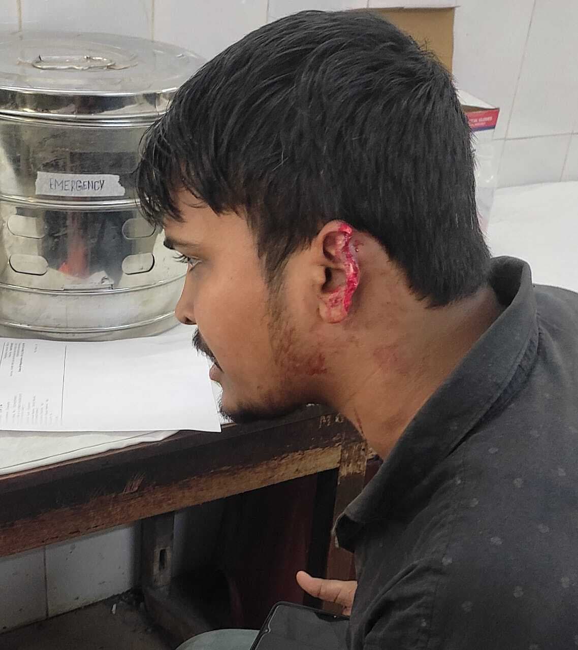 सीतारामडेरा : घर के पास नशा करने से रोका, तो युवक का कान काटा
