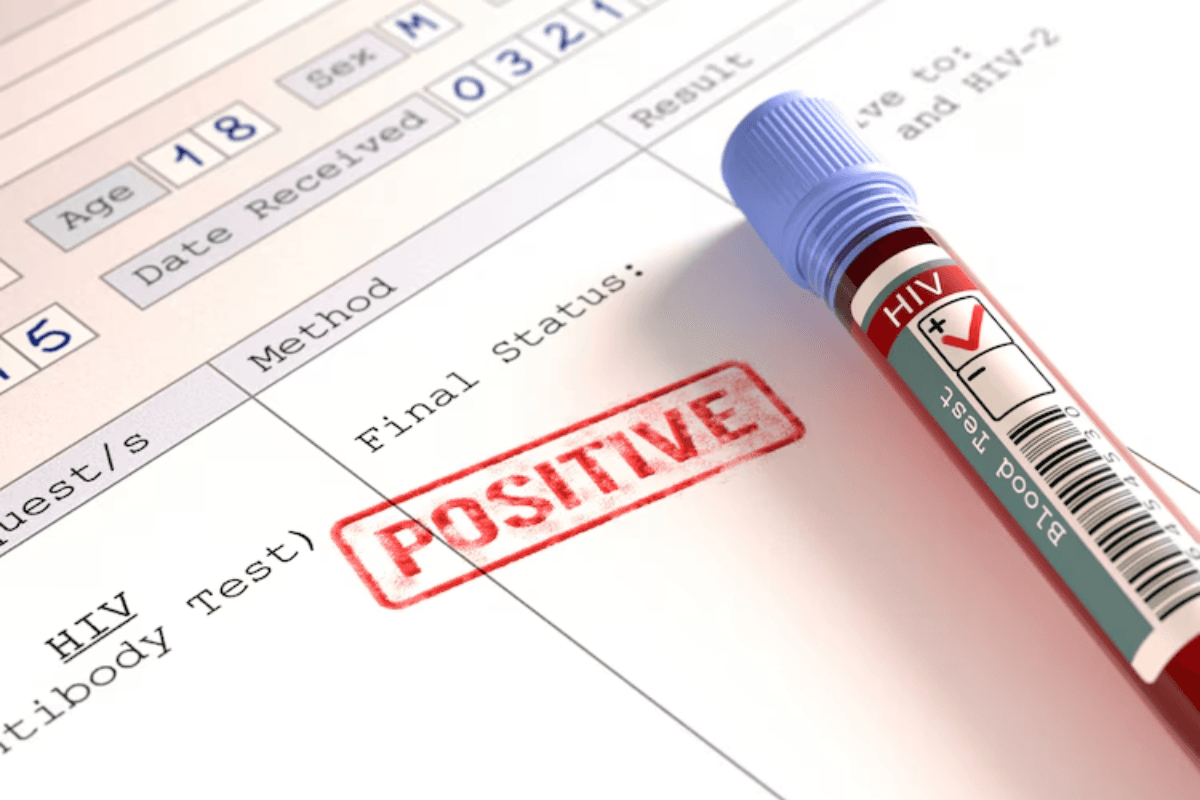 Muzaffarpur News: जिले में HIV के 5600 मरीज, SKMCH के एआरटी सेंटर से ले रहे दवा