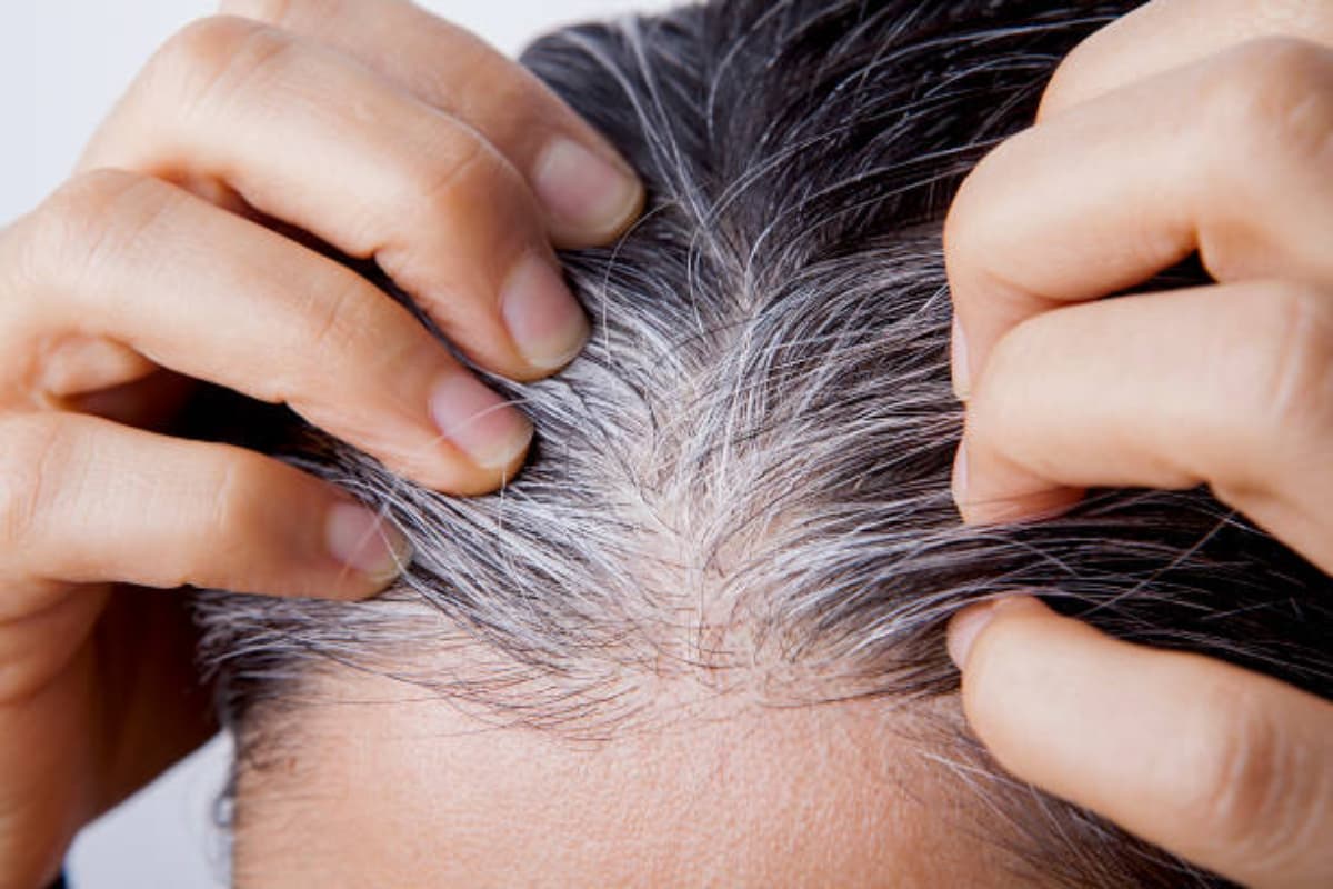 Hair Care Tips: बिना केमिकल के सफेद बालों का पक्का इलाज, घर में रखी सिर्फ इस चीज का करें इस्तेमाल