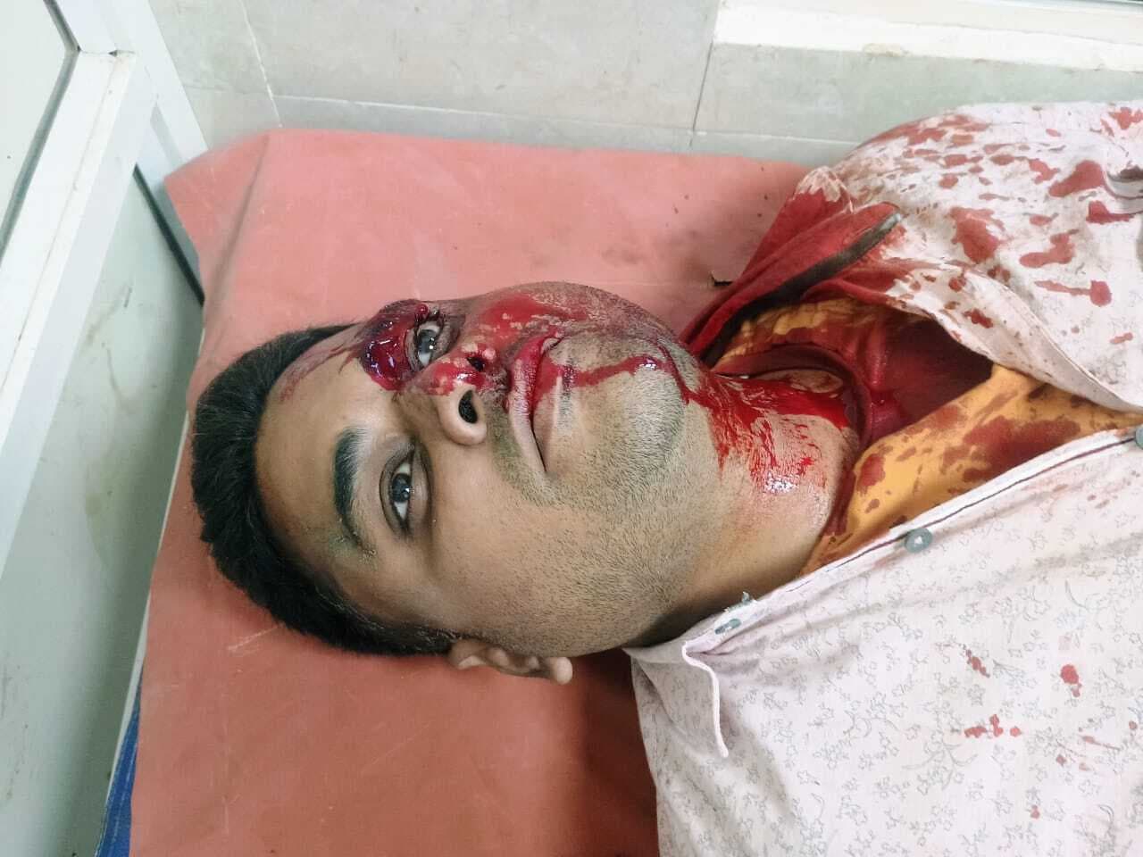 भूमि विवाद को लेकर हुई मारपीट, आधा दर्जन से अधिक लोग घायल, इलाजरत