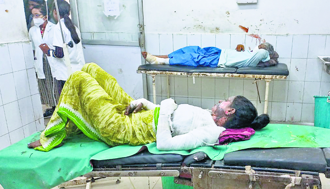 DHANBAD NEWS : रात को गैस का नॉब बंद करना भूल गयी थी महिला, सुबह में झुलसी