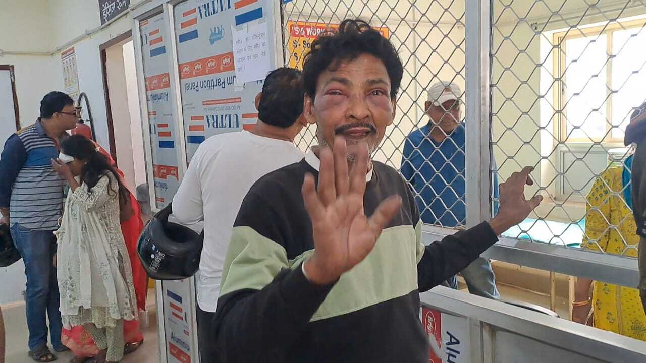 आठ माह बाद तथाकथित अपहृत लौटा गांव, चोर समझ कर ग्रामीणों ने बुरी तरह पीटा