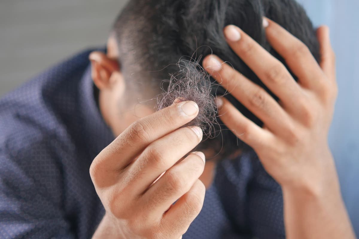 Hair Care Tips: कहीं इन गलतियों की वजह से तो गंजे नहीं हो रहे हैं आप? समय रहते करें सुधार