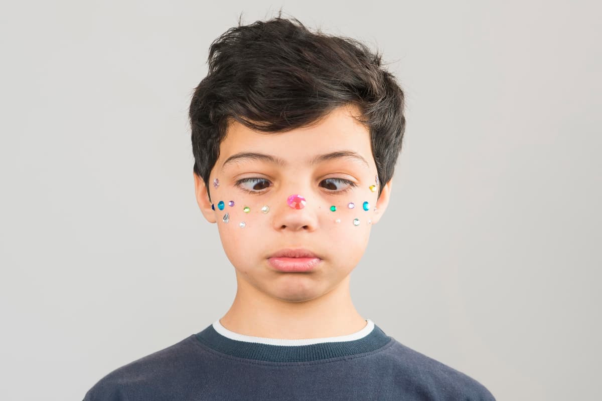 Parenting Tips: बच्चे के चेहरे पर निकल आए एक्ने और पिंपल्स? आज ही डायट से हटाएं ये चीजें
