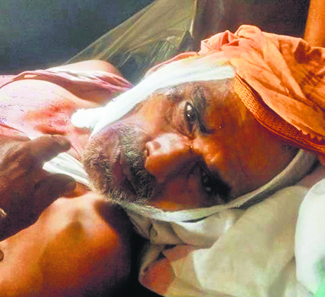 Chhapra News : सोनपुर में आंगनबाड़ी विवाद को लेकर हमला, छह लोग घायल