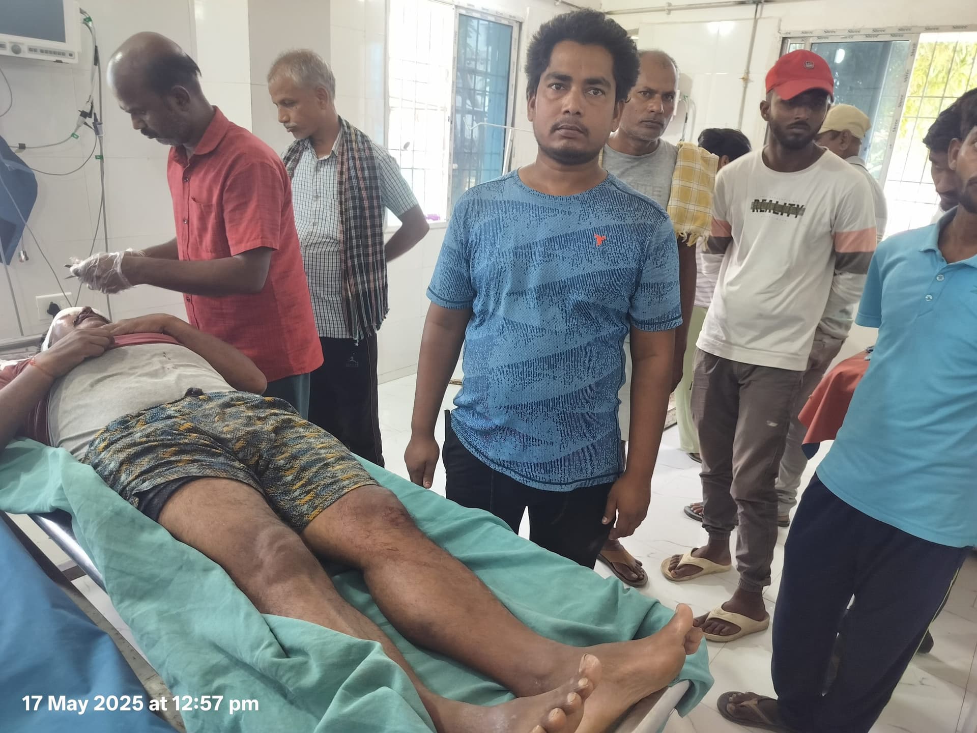 बाइक से ड्यूटी जा रहे इंजीनियर सहित दो जख्मी