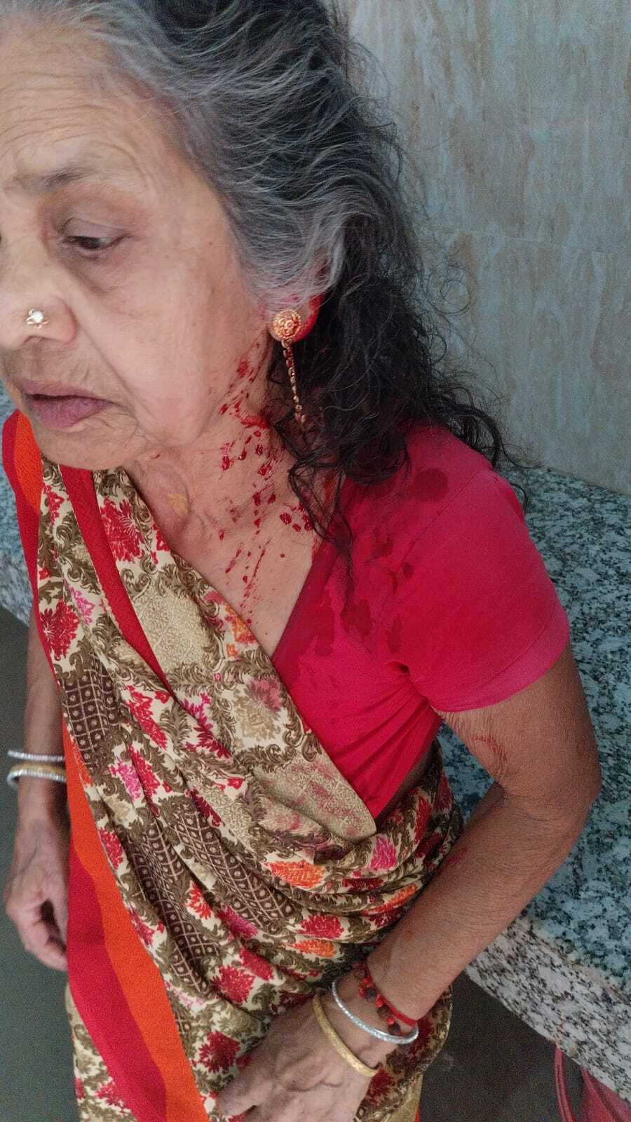 पत्नी के साथ मिलकर पुत्र ने वृद्ध मां को पीटकर किया जख्मी