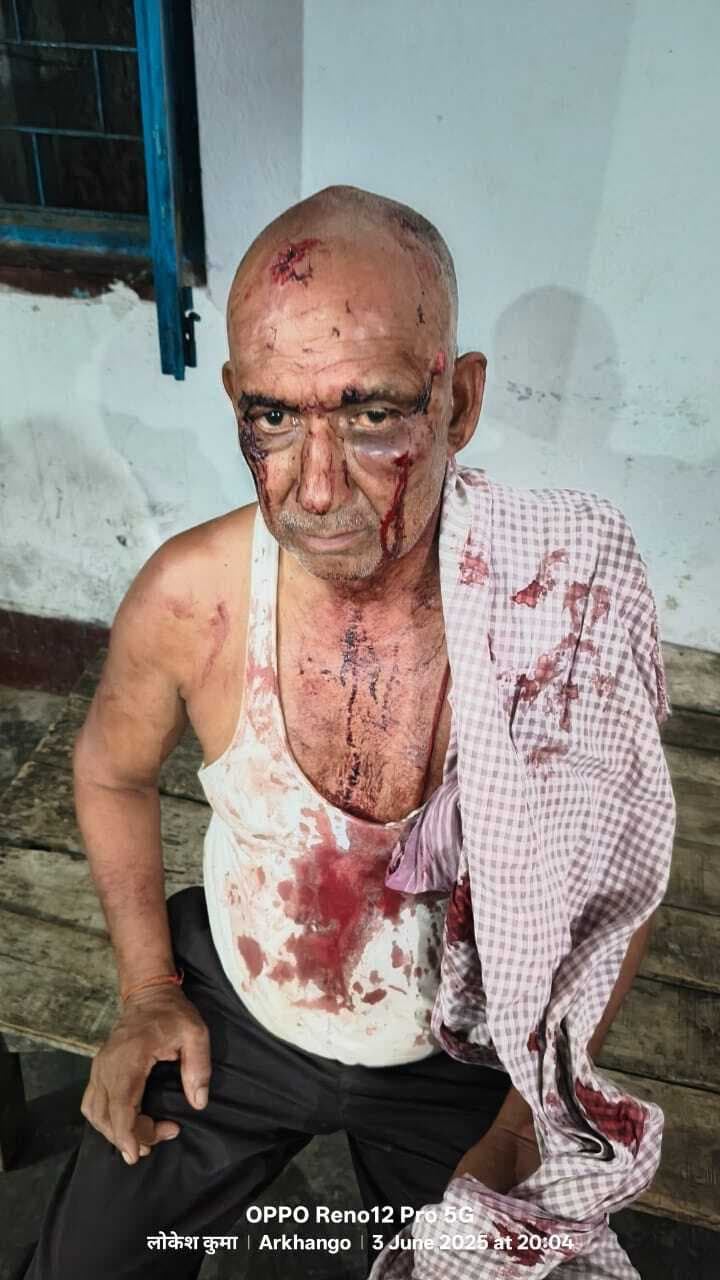 Giridih News: आम तोड़ने से मना किने पर मारकर घायल किया