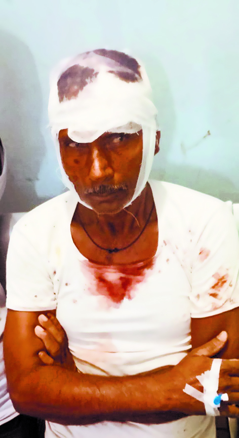 Gopalganj News : फुलवरिया में ऑर्केस्ट्रा के दौरान कुर्सी के विवाद में खूनी संघर्ष, 12 घायल, दो की हालत नाजुक