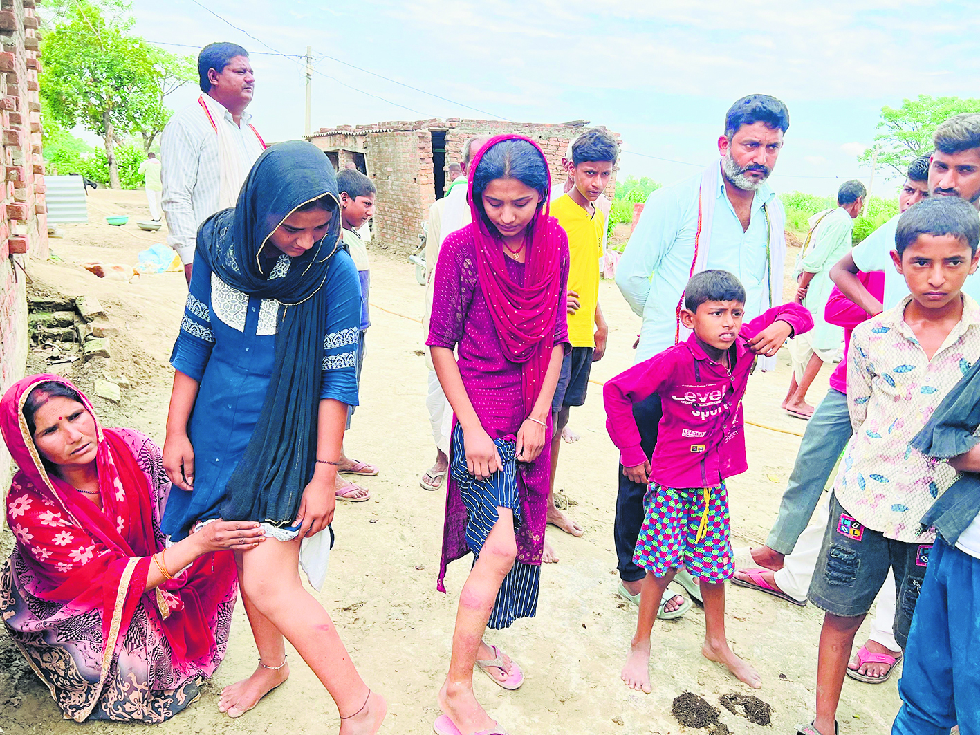 Gopalganj News : फुलवरिया में पुलिस ने लोगों को पीटा, यूपी के मजदूर की मौत, कई महिलाएं व बच्चे जख्मी
