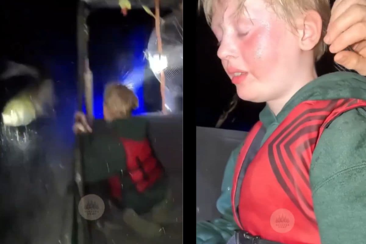 Viral Video: मछली की थप्पड़ ने सुजा दिया गाल, दर्द से ऐसी हो गई बच्चे की हालत, वायरल हो रहा वीडियो