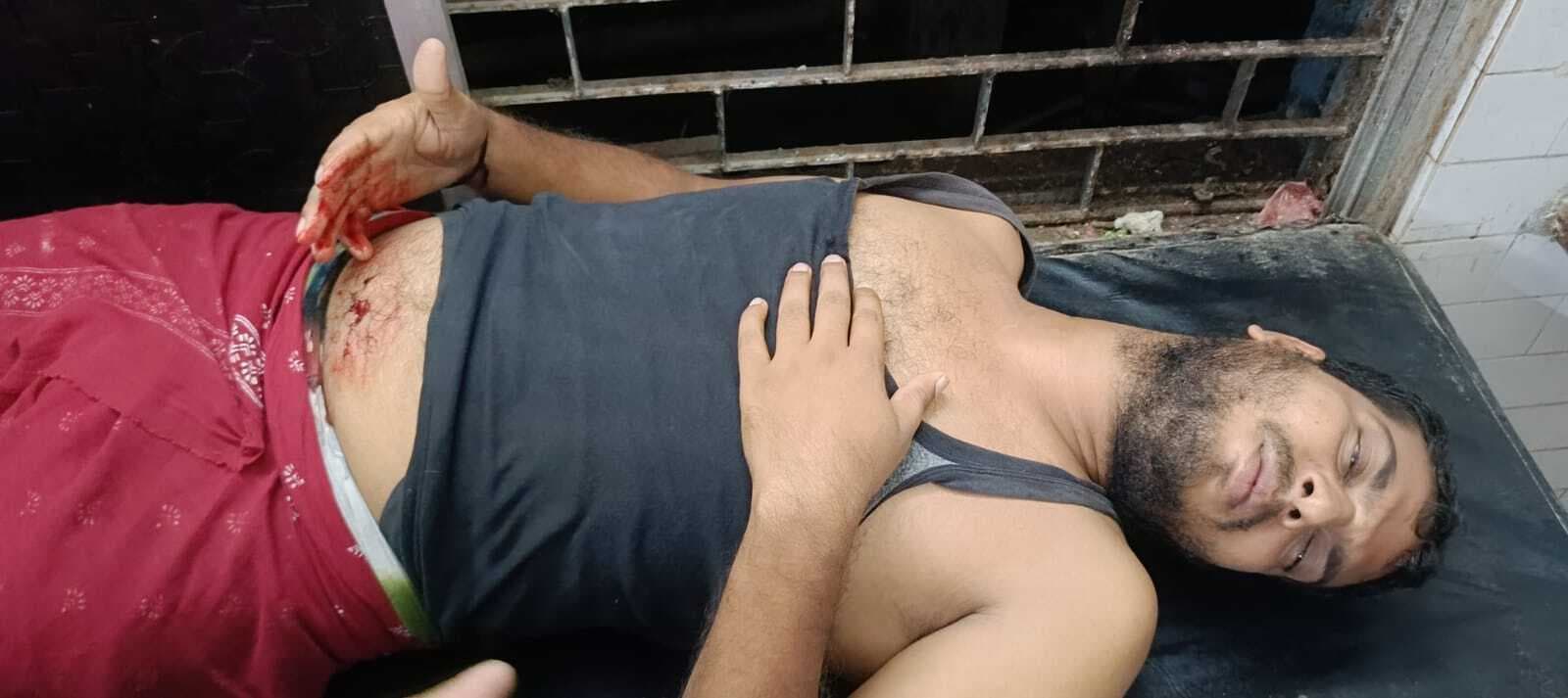 घर से निकाल कर युवक के पेट में मारा चाकू, भर्ती