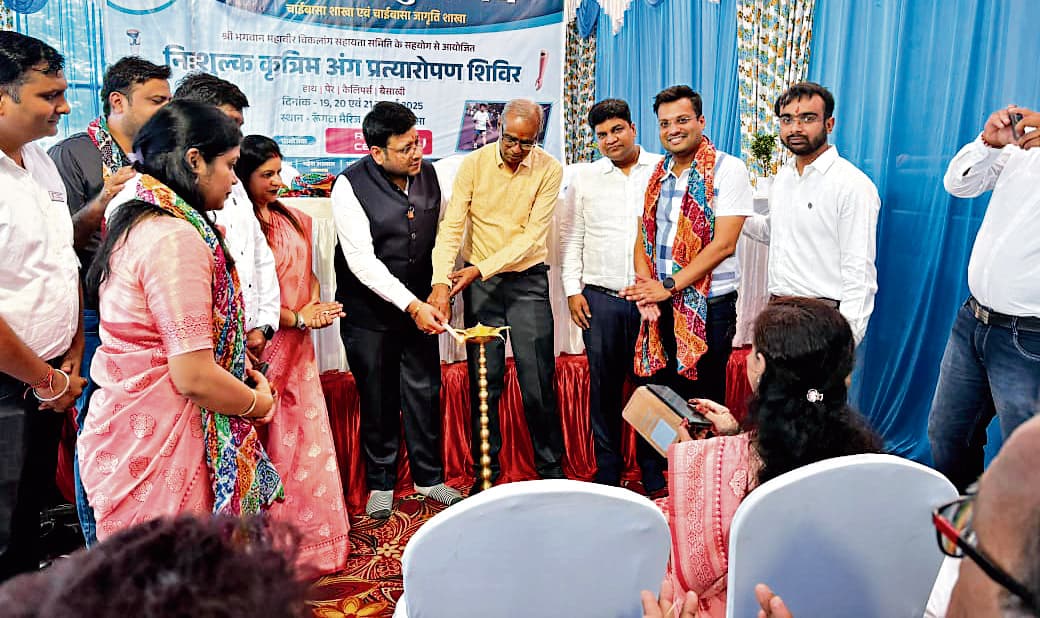 Chaibasa News : 54 का रजिस्ट्रेशन हुआ, कृत्रिम अंग मिलेंगे