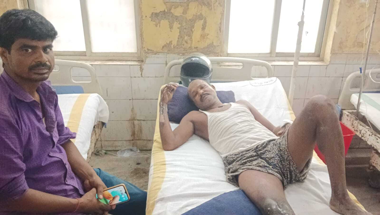 हाइ टेंशन तार की चपेट में आने से मजदूर झुलसा, अस्पताल में भर्ती