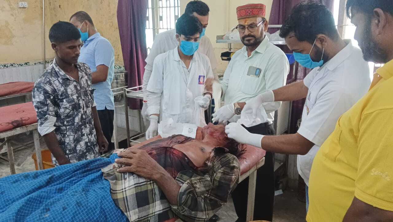घरेलू विवाद में पत्नी ने की मारपीट, पति गंभीर रूप से घायल