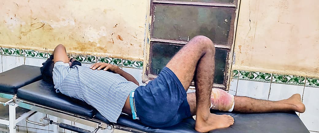 Gopalganj News : पुलिस के साथ मुठभेड़ में ज्वेलरी दुकान में लूट के आरोपित को लगी गोली