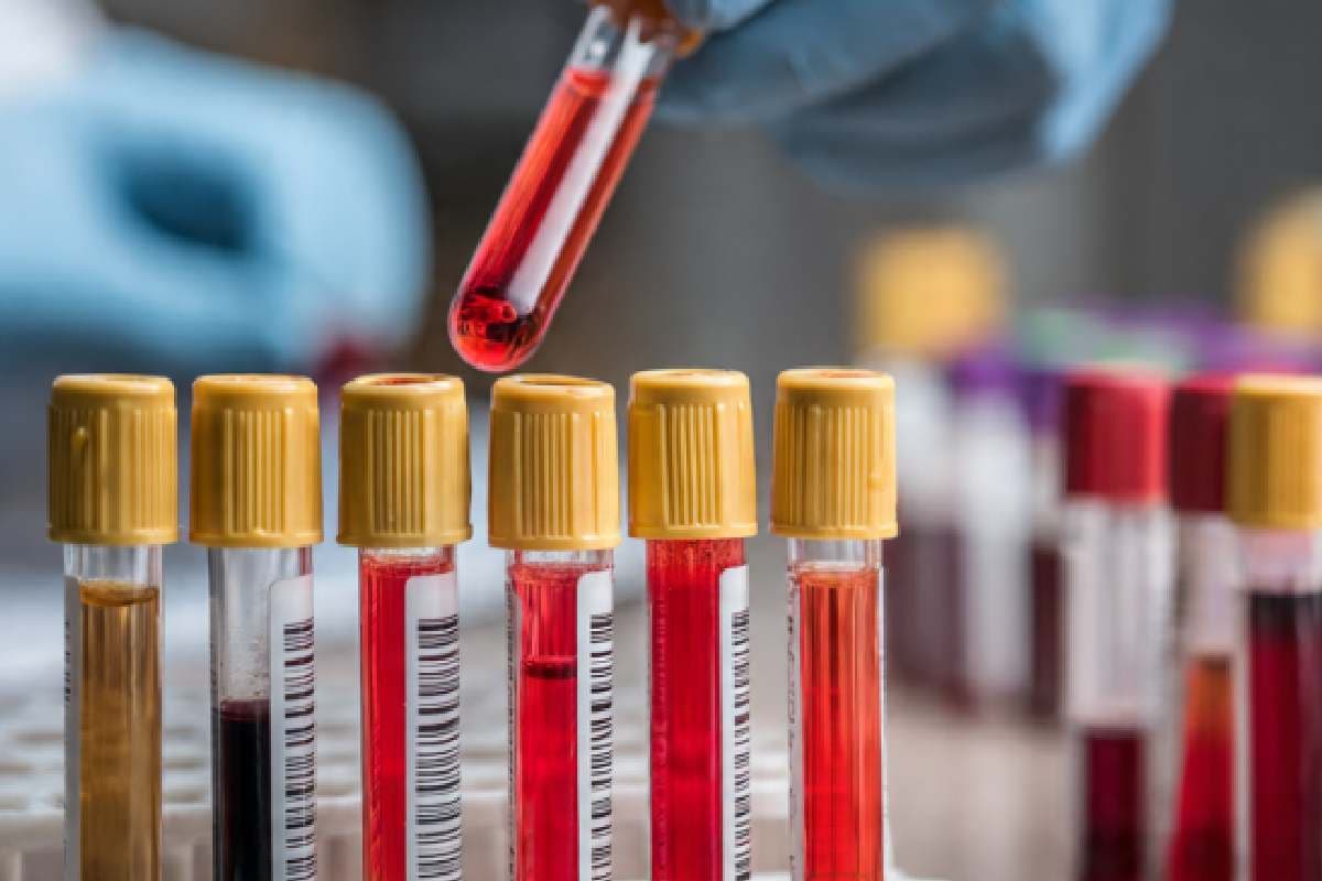 New Blood Test : नई ब्लड टेस्ट से सिर और गले के कैंसर का पता 10 साल पहले लगाना संभव
