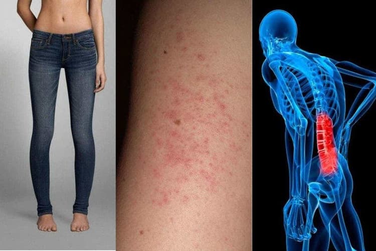 Tight Jeans Side Effects: फैशन नहीं खतरा, लगातार टाइट जींस पहनने से हो सकता है ये सीरियस प्रॉब्लम